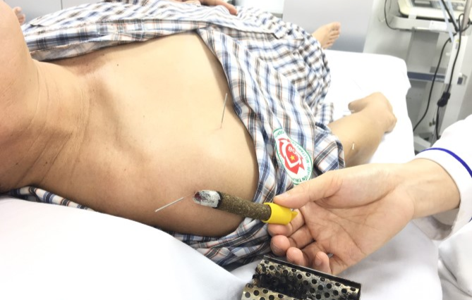 Dụng cụ cứu ngải toàn thân